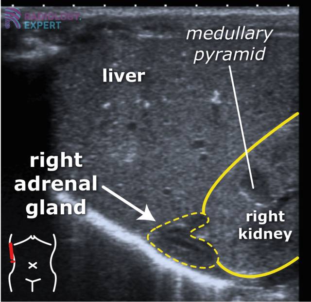 Abdominal ultrasound